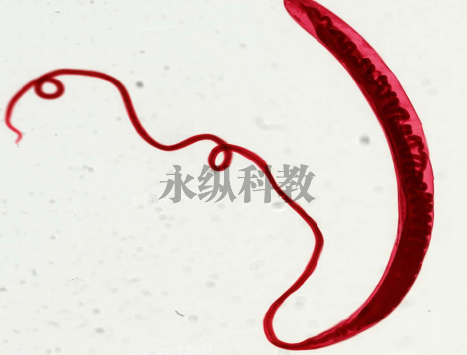鞭虫(雌虫)