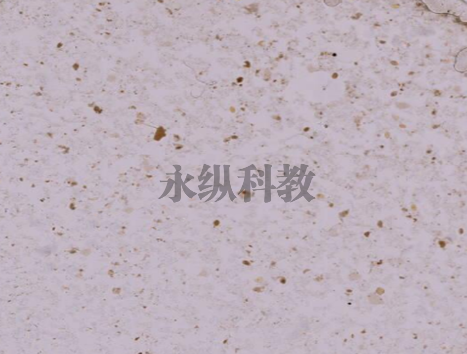 布氏姜片吸虫虫卵