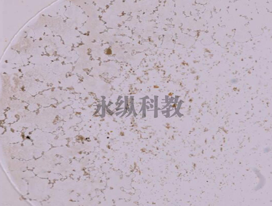 肝吸虫卵