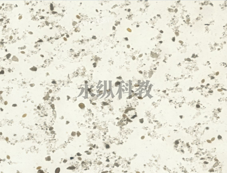 曼氏迭宫绦虫卵