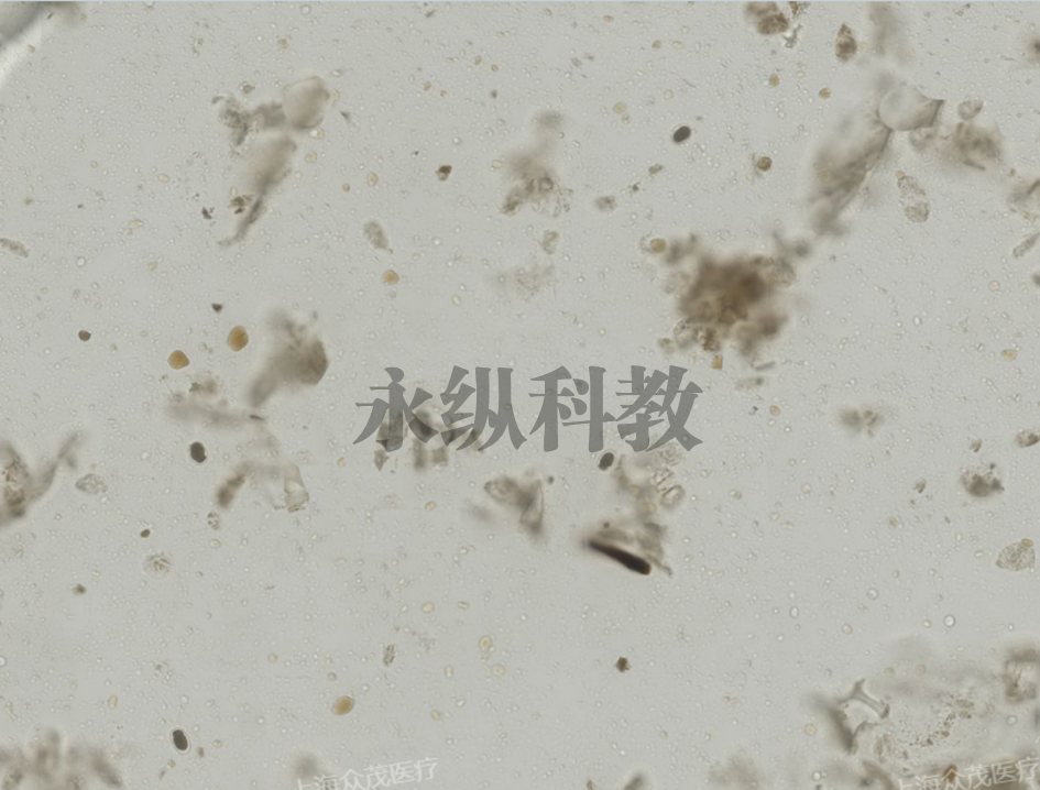 十二指肠钩口线虫虫卵