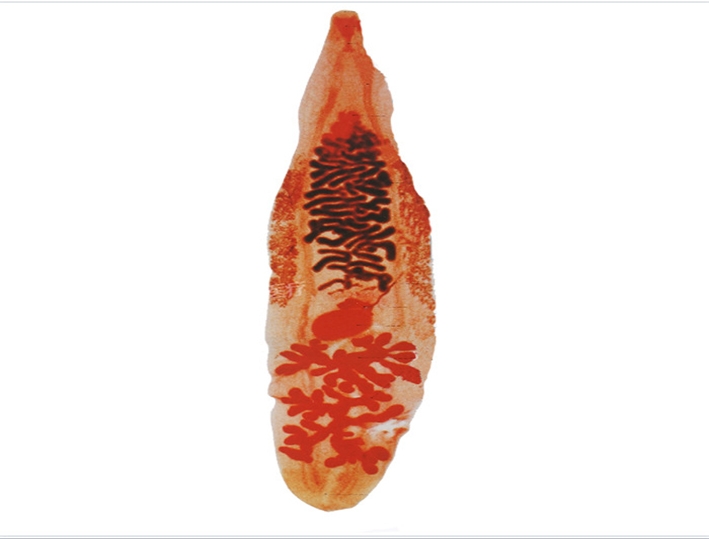 华支睾吸虫(肝吸虫)成虫