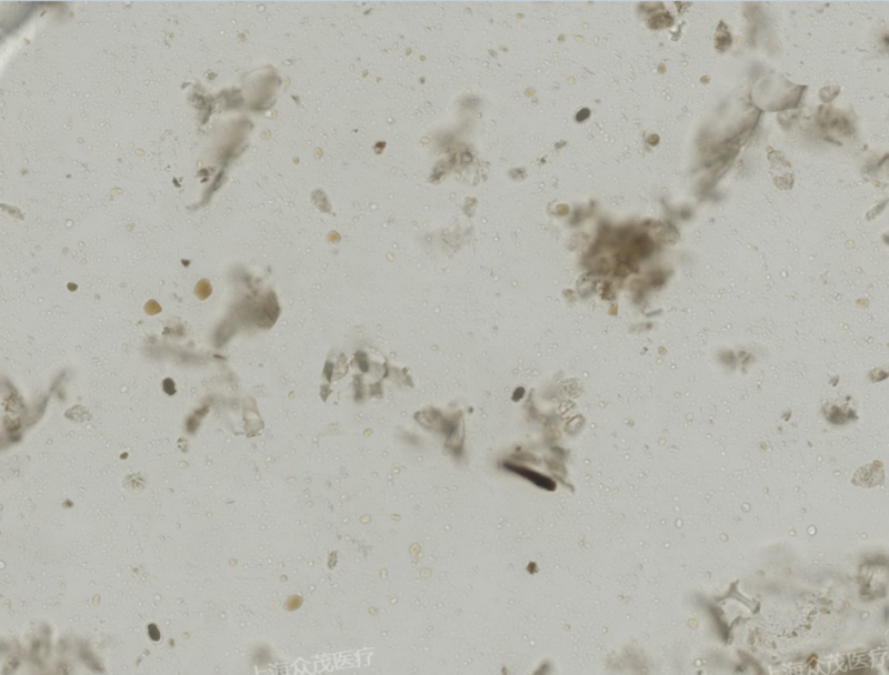 十二指肠钩口线虫虫卵