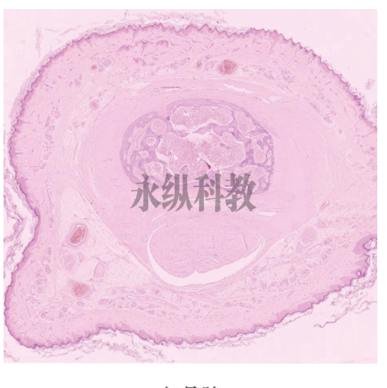 生物切片