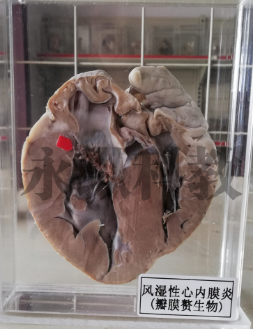 病理标本