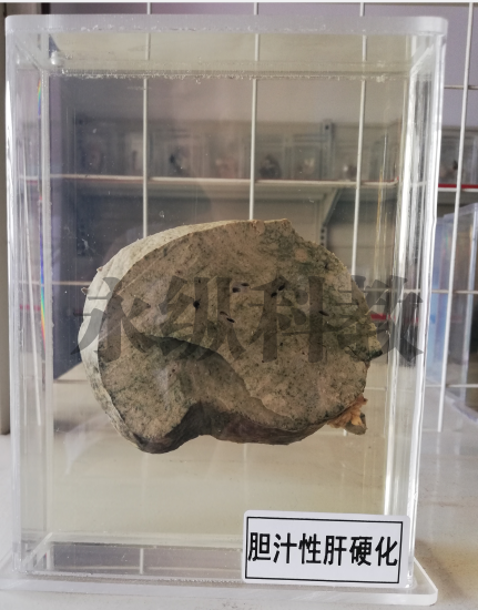 病理标本
