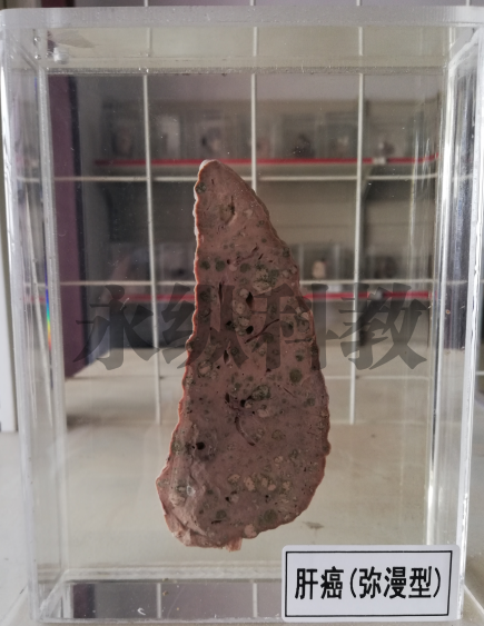 病理标本