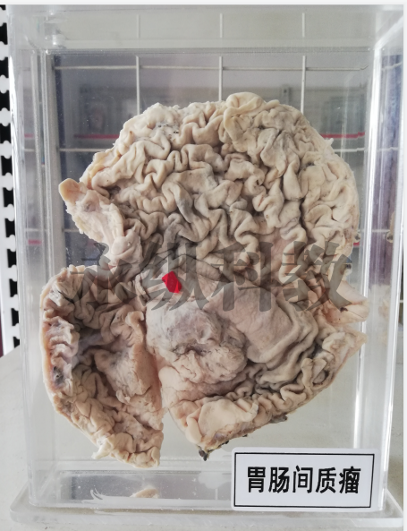 病理标本