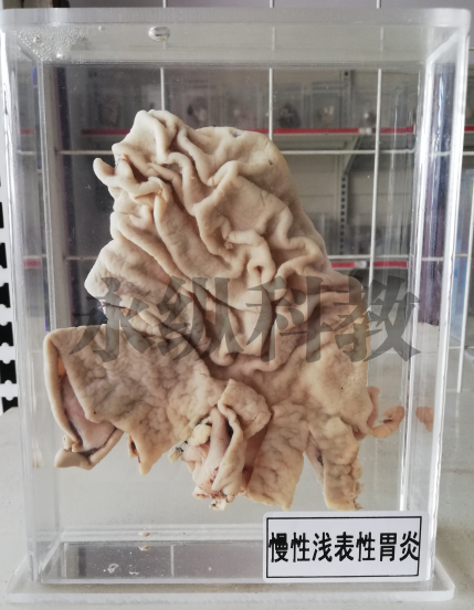 病理标本