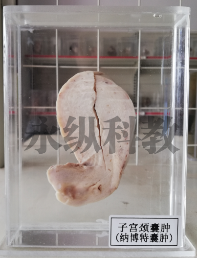 病理标本