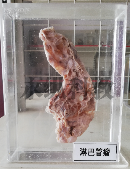 病理标本