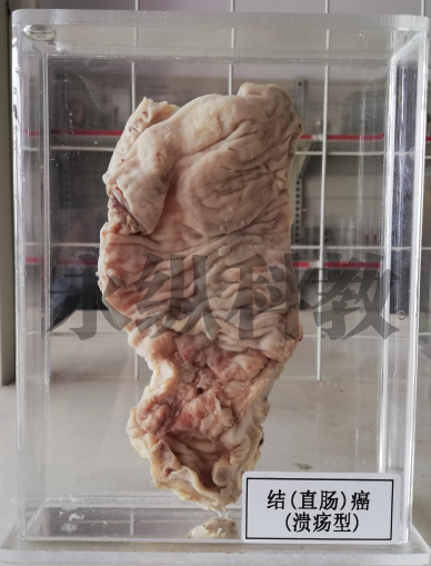 病理标本