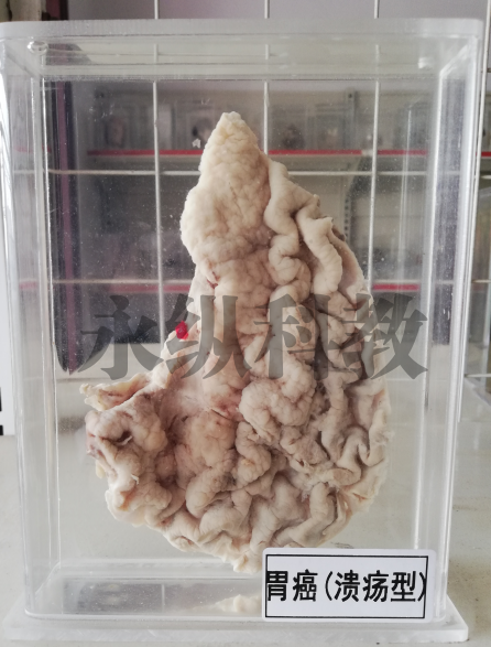 病理标本