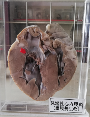 病理标本