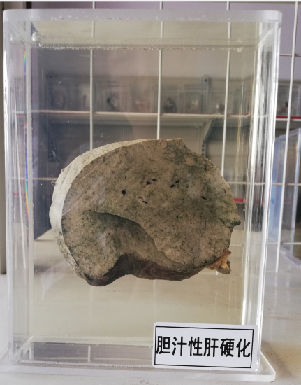 病理标本