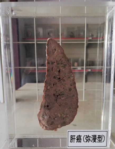 病理标本