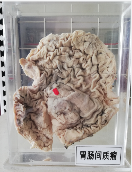 病理标本