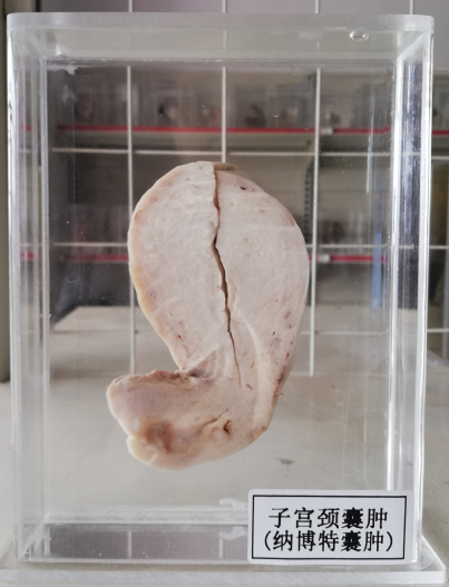 病理标本