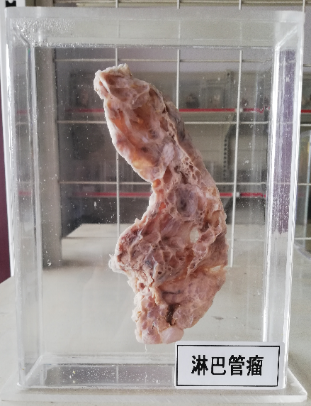 病理标本