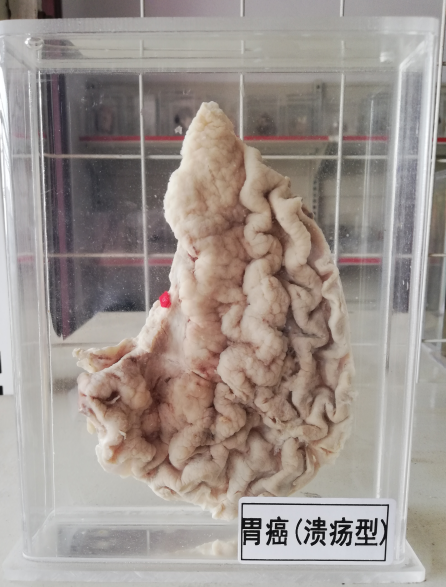 病理标本