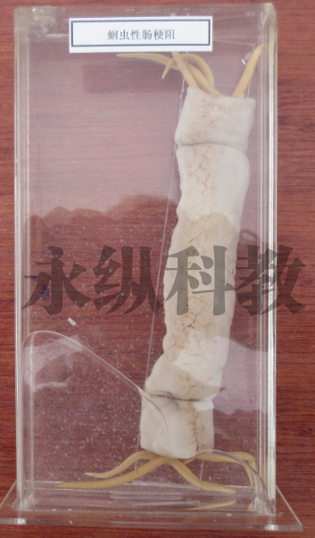 寄生虫标本
