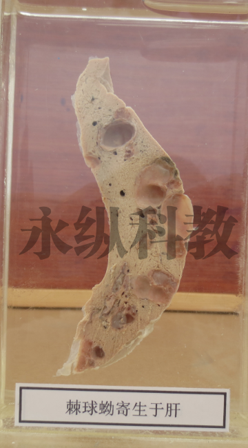 寄生虫标本