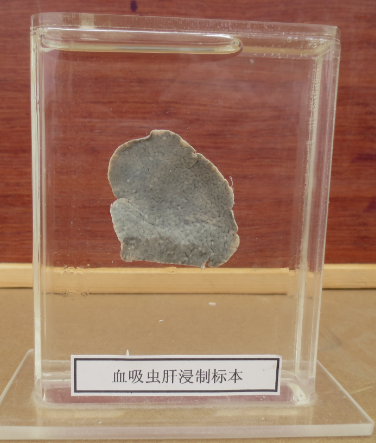 寄生虫标本