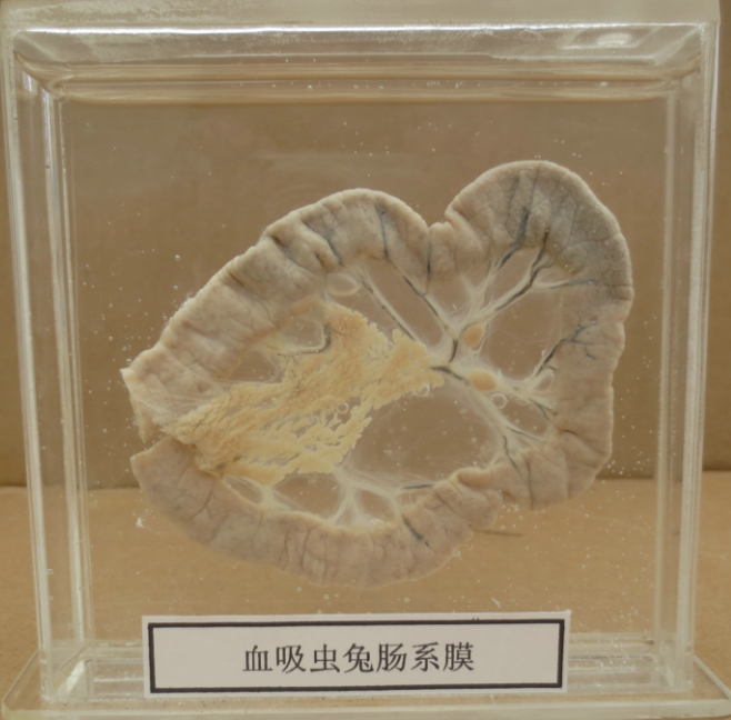 寄生虫标本