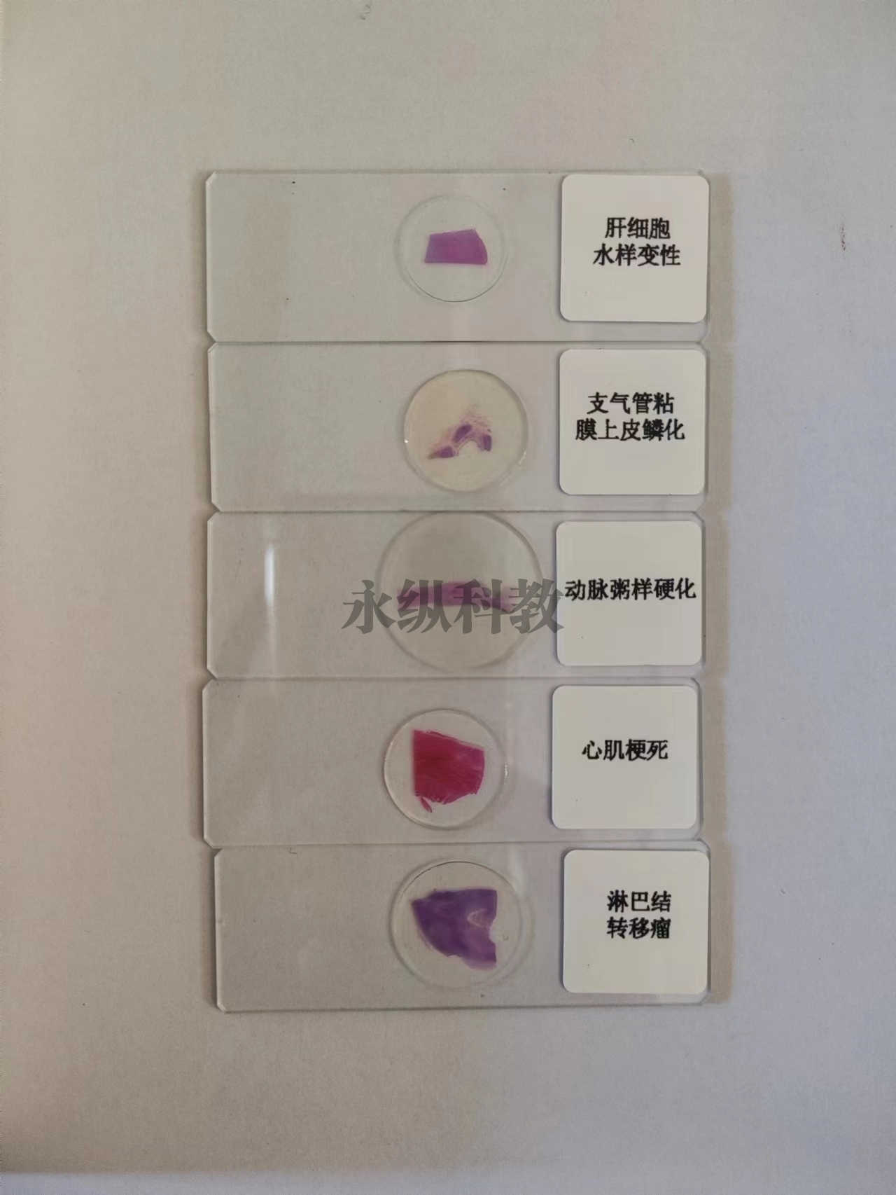 病理切片
