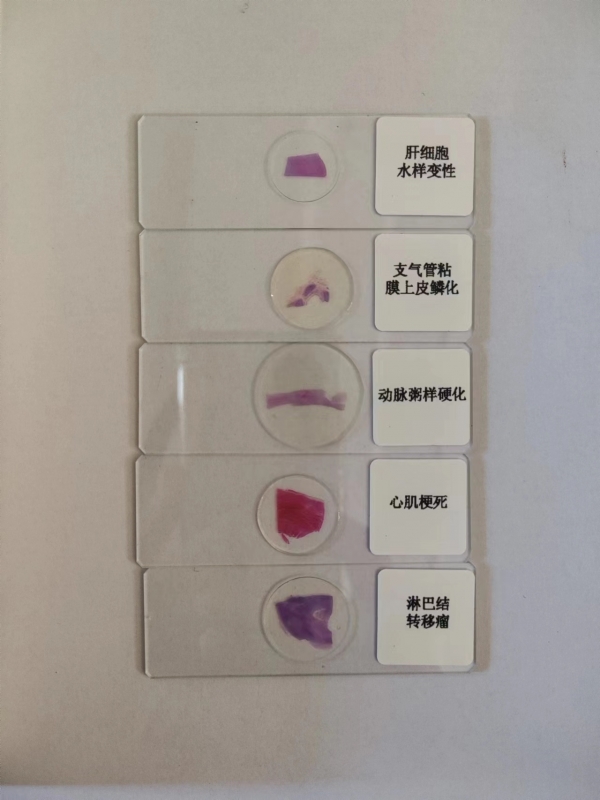 病理切片