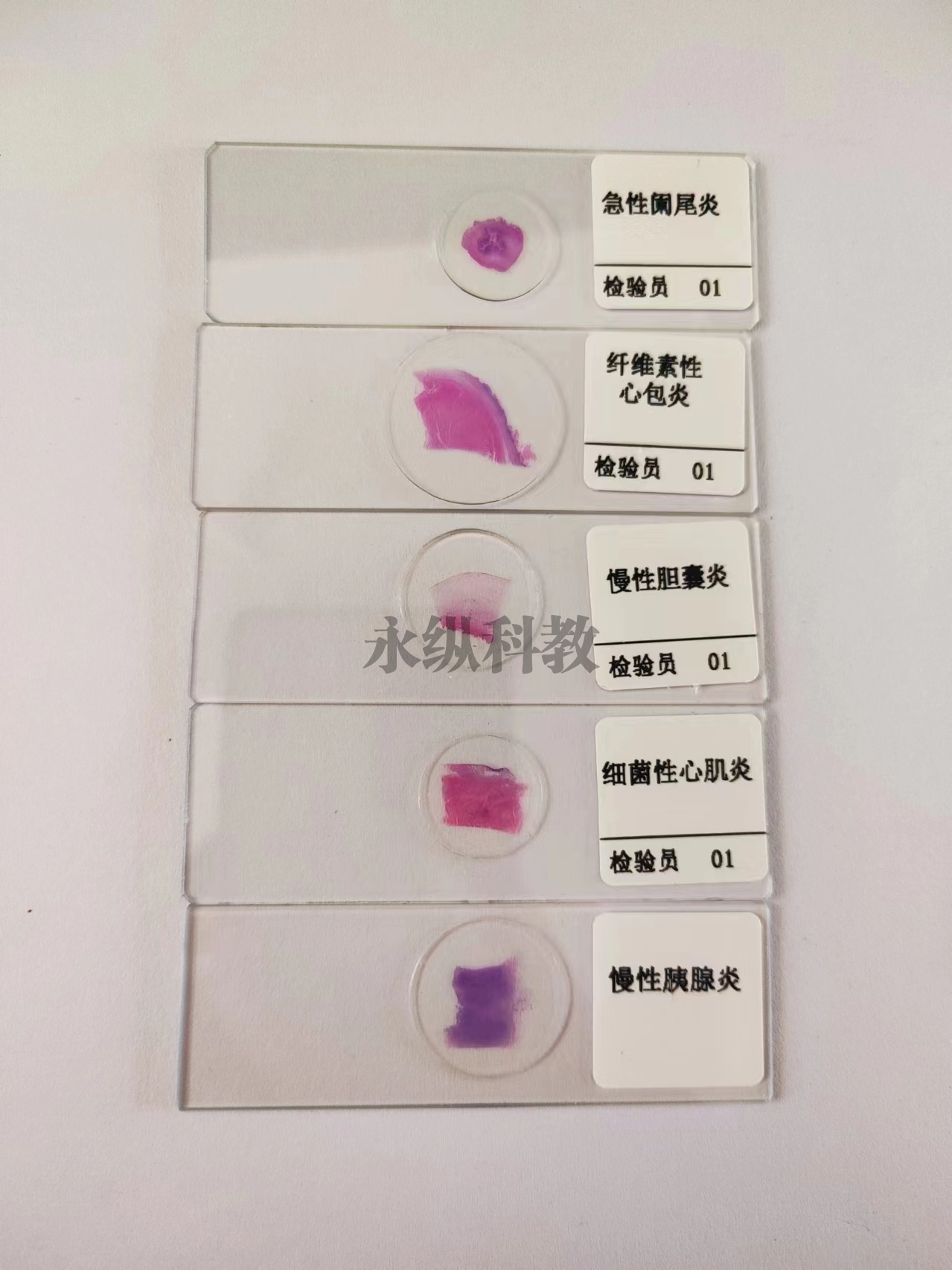 病理切片