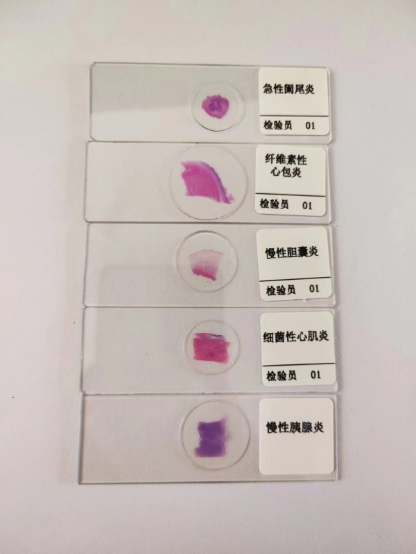 病理切片