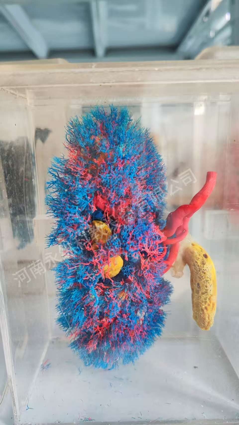 肾铸型标本
