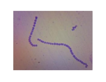 生物切片涂片和装片怎么区分