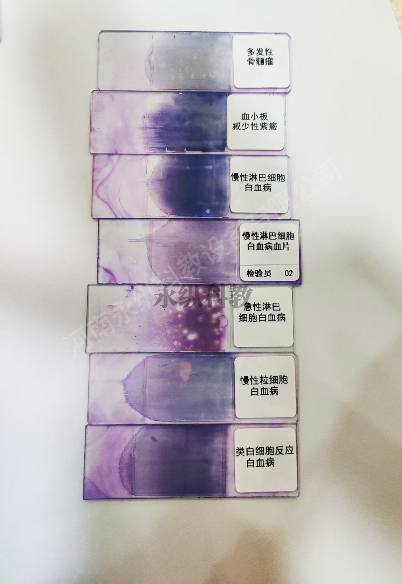 血液病理切片