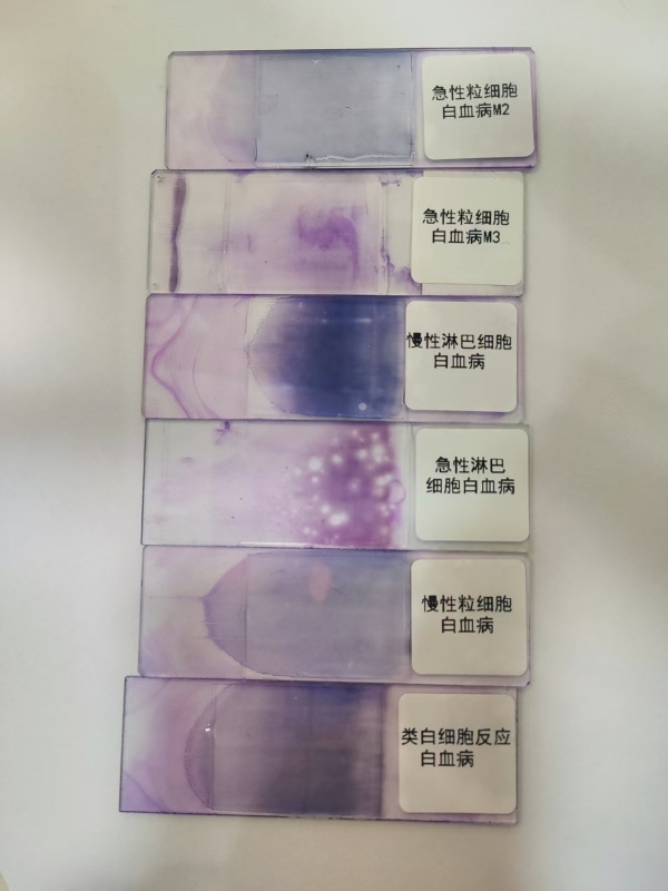 血液病理切片
