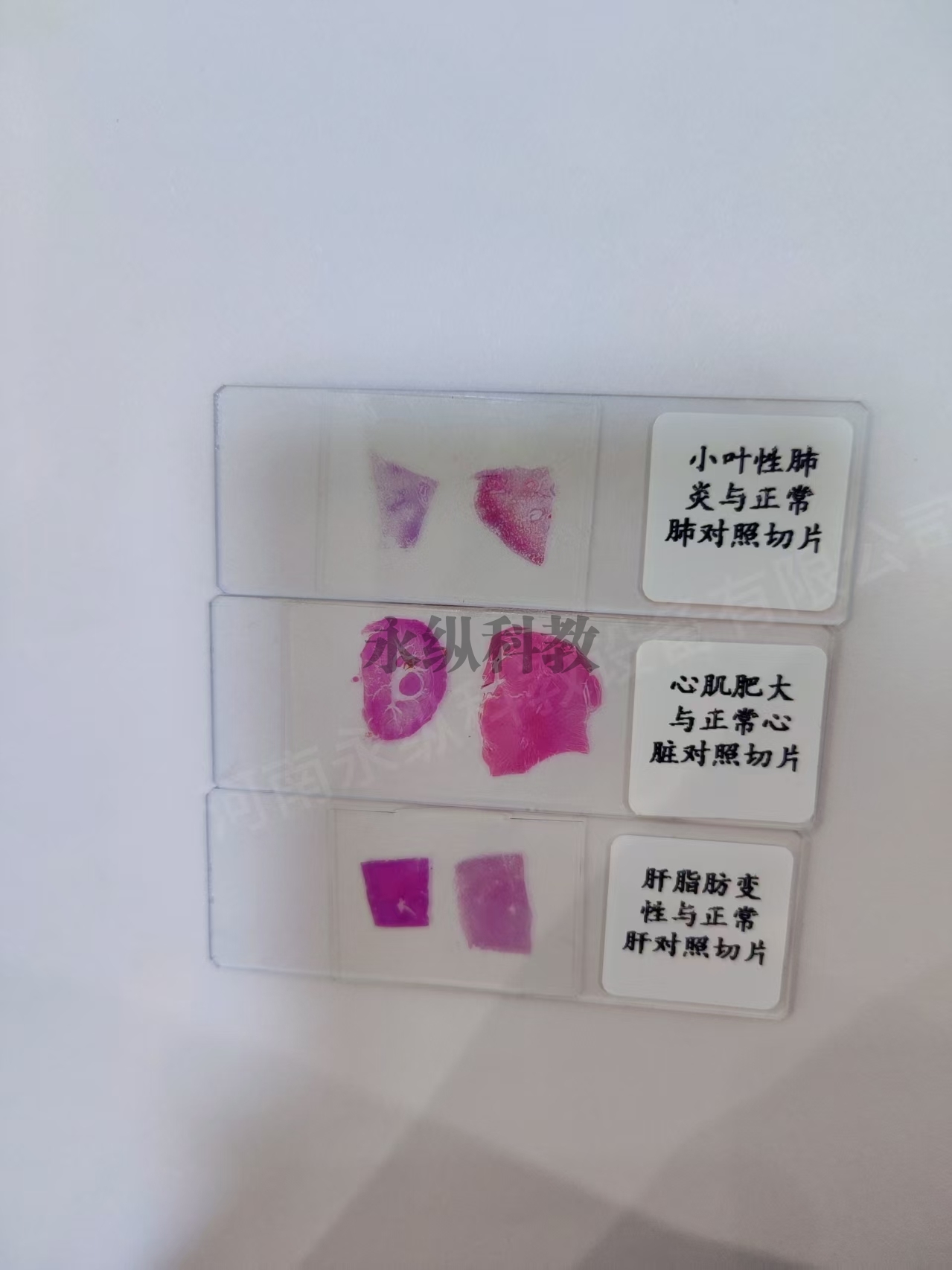 病理组织与正常组织对照切片