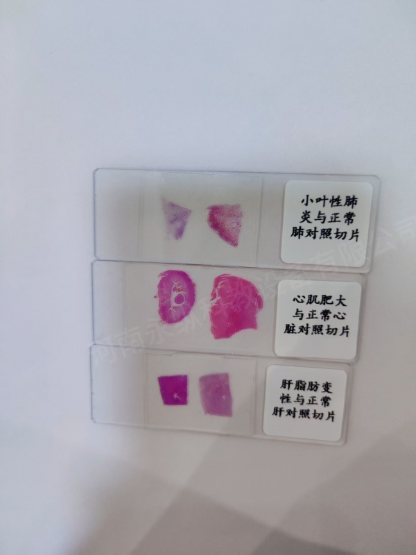 病理组织与正常组织对照切片
