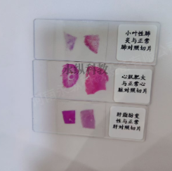 病理切片与普通生物切片的区别与应用 病理切片与普通生物切片的区别与应用